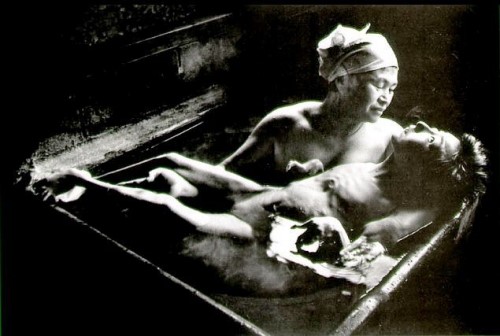 Bệnh nhân mắc bệnh Minamata có các triệu chứng tê liệt, co giật đến tử vong